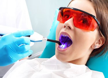 tooth fillings
